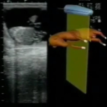 فیلم آموزشی تشخیص آبستنی و سن و جنسیت جنین در گاو و اسب با سونوگرافی